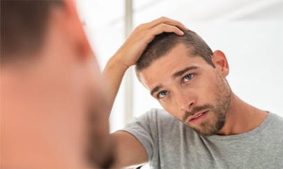 Coping with Hair Loss in Your 30’s