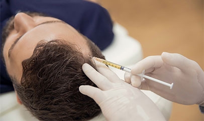 Does PRP Hair Loss Treatment in Newport Beach and Beverly Hills Really Stop Hair Shedding?