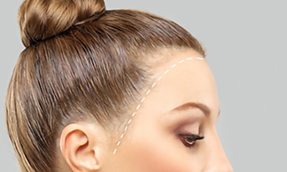FUE vs. FUT: Which Hair Transplant Surgery in Newport Beach Is Right for You?