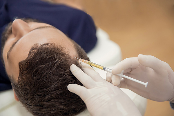 Does PRP Hair Loss Treatment