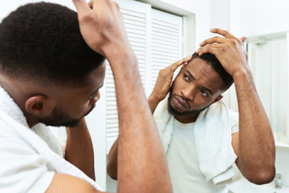 Top 10 Causes of Hair Loss
